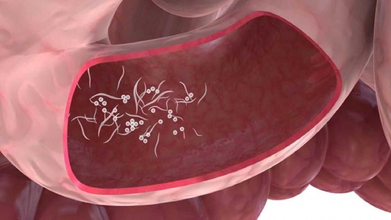 Paraziții Giardia în ficat