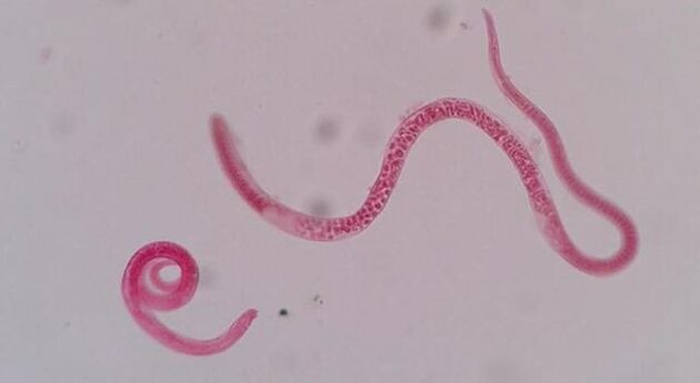 cum arata trichinella