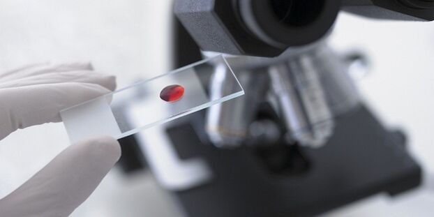 test de sânge pentru a diagnostica paraziții din organism